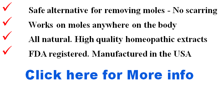 homeopathic treatment for moles