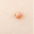 Wart_on_butt