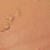 How to remove warts